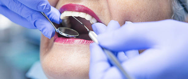 Best Emergency Dentist for Lost Fillings or Crowns in Egypt, PA